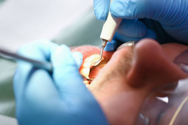 Best Pediatric Emergency Dentist in Choteau, MT