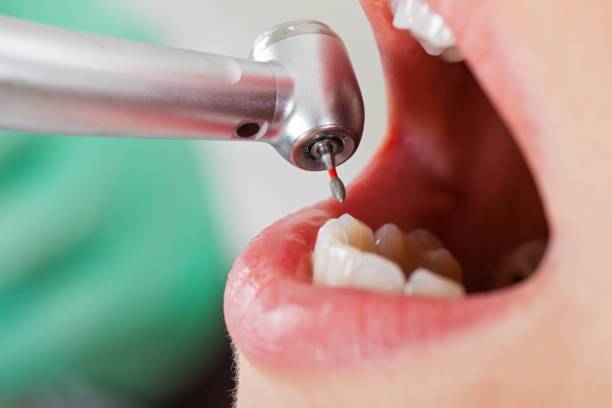 Best Walk-In Emergency Dentist in Choteau, MT